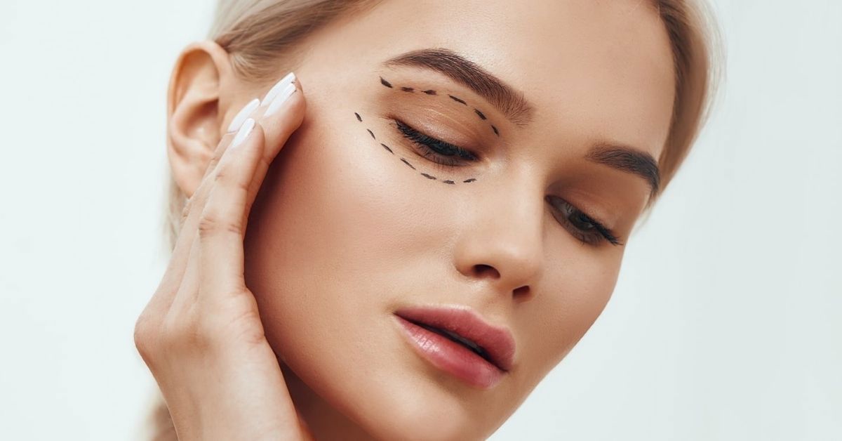 Upper Eyelid Aesthetics