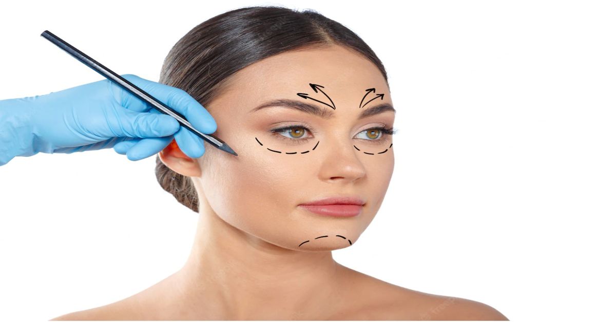 What is Lower Eyelid Aesthetics?