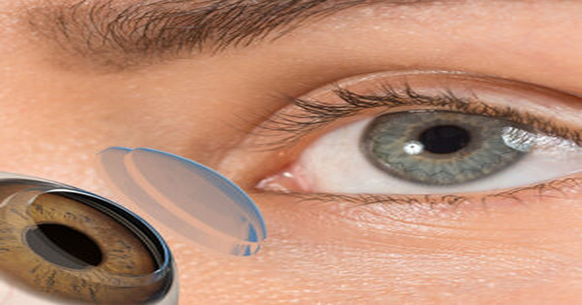 Corneal Inflammation