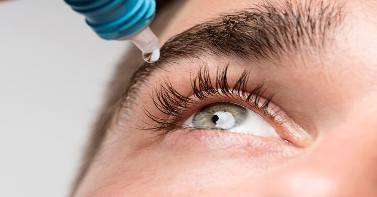 Dry Eye Syndrome
