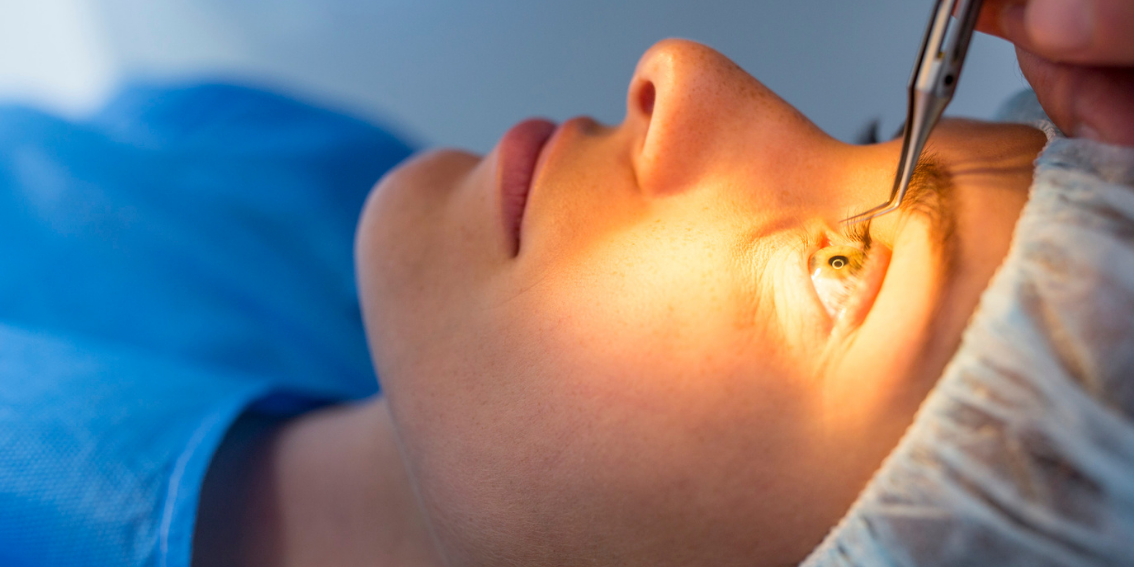 LASIK Göz Ameliyatı Nedir? İyileşme Süreci Nasıldır? Avantajları Nelerdir?